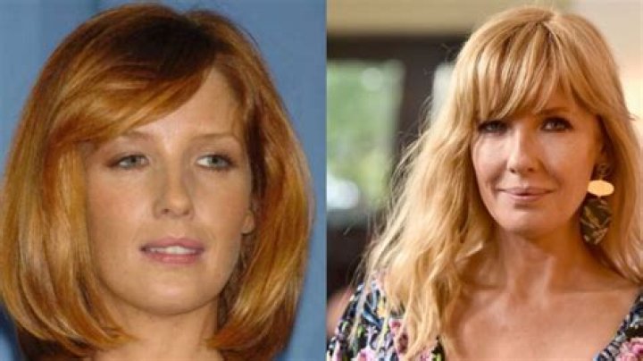 Did Kelly Reilly Get Lips Surgery? Before And After Photos