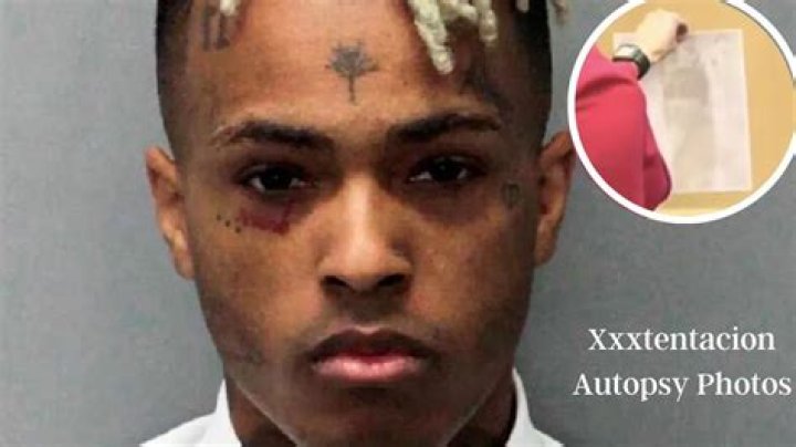 Xxxtentacion autopsy picture, like King Von’s, leaked on Reddit and Twitter, fan Scott Barbieux questioned